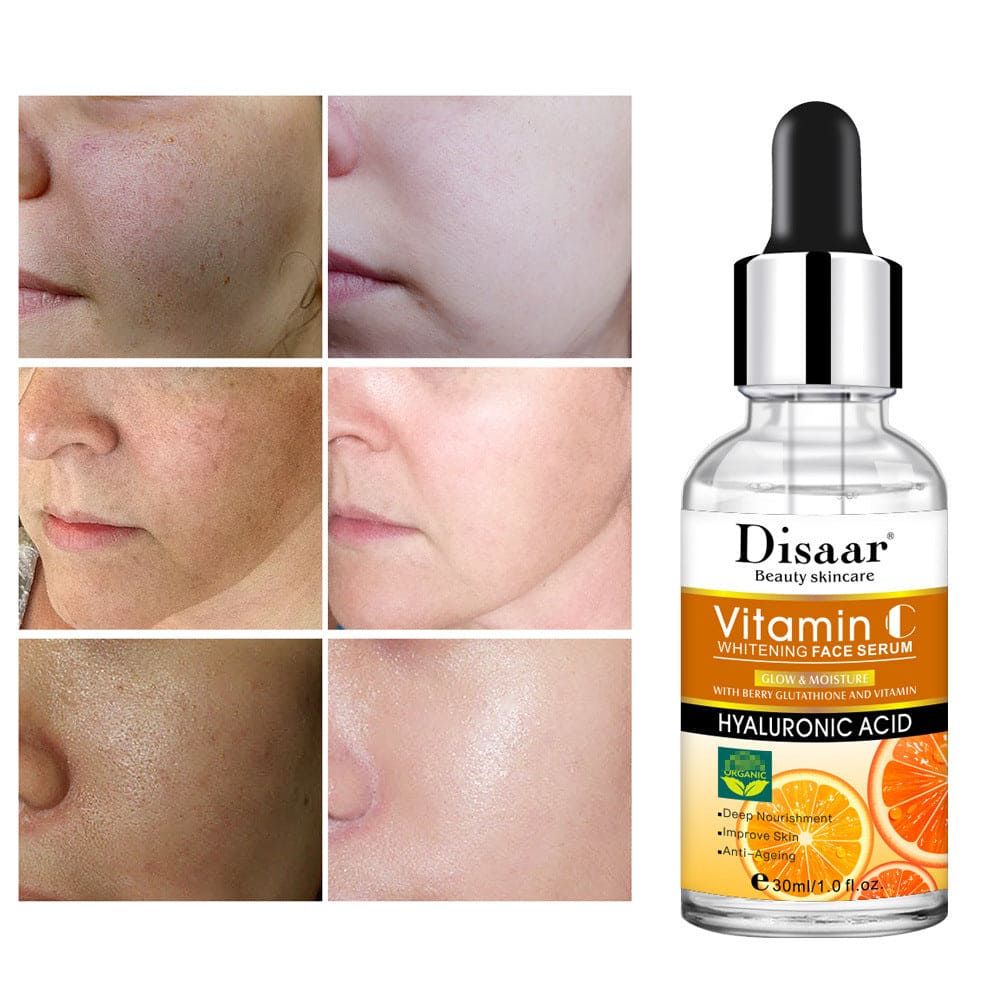 Hyaluronic Acid Vitamin C Face Serum Whitening-Beauty Product-Tept Markets